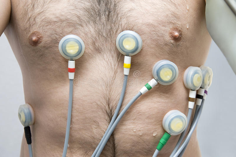 What are The Reasons a Person Would Get an EKG?