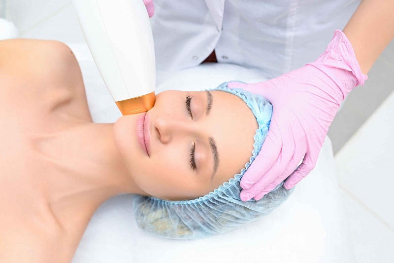 Important Things to Know About Laser Facial Resurfacing