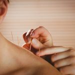 Acupuncture For Neck Pain