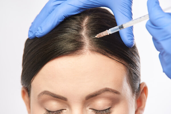 Plasma injection for hair