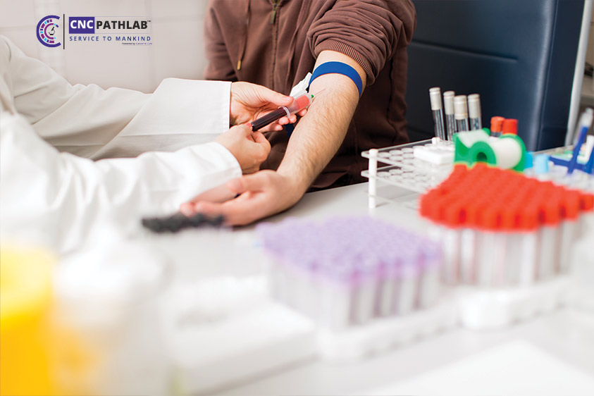 Blood Test Price in Delhi